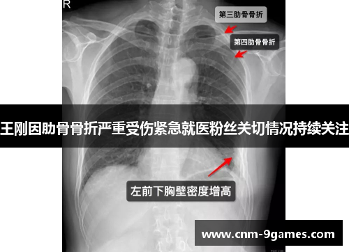 王刚因肋骨骨折严重受伤紧急就医粉丝关切情况持续关注